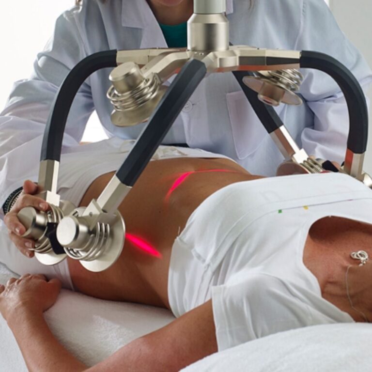 A Gentle Approach to Body Transformation and The Complete Guide to the Zerona Z6 Laser